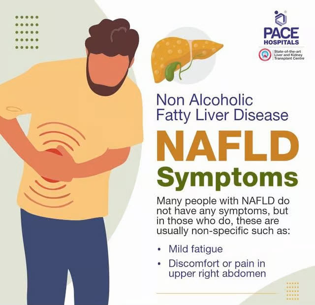MASLD / NAFLD / MAFLD Symptoms