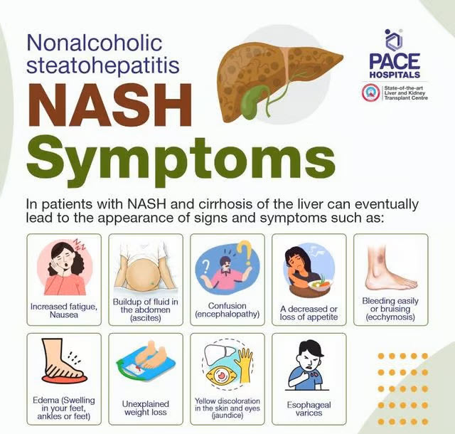 NASH Symptoms