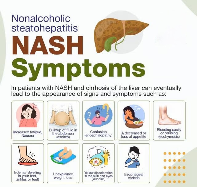 NASH Symptoms